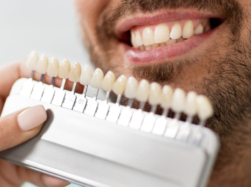 Dental Veneers vs. Implants: Pros and Cons