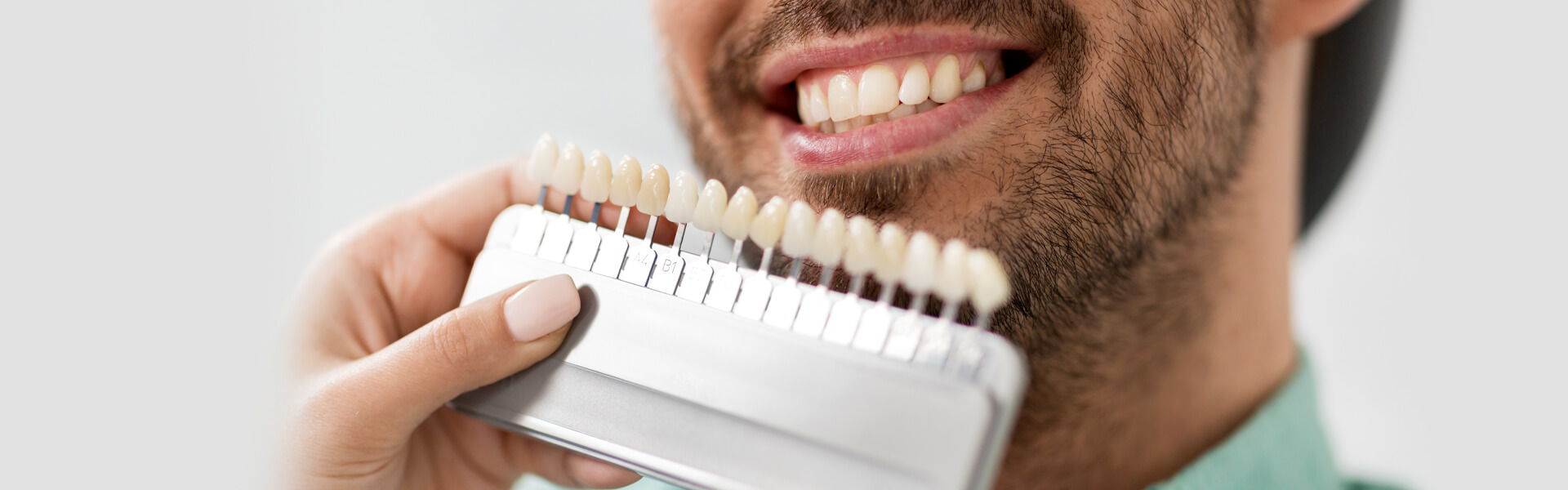 Dental Veneers vs. Implants: Pros and Cons